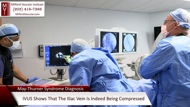 IVUS Intravascular Ultrasound Procedure New Haven CT for Diagnosing May-Thurner Syndrome