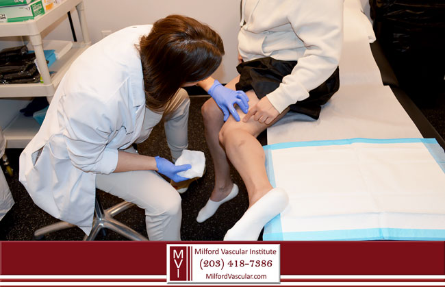 Free Vein Consultation For Spider Vein Treatment New Haven CT