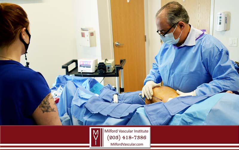 Varicose Vein Surgeon New Haven CT Radiofrequency Ablation