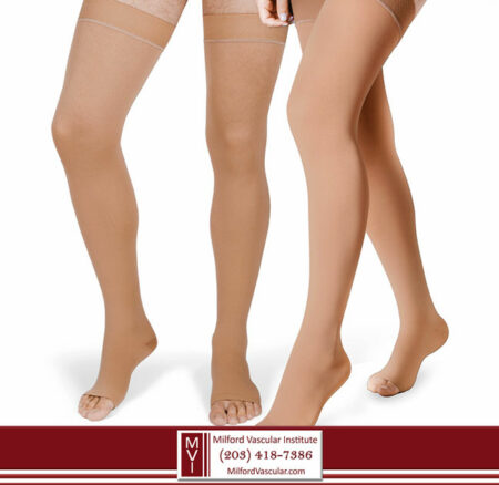 Varicose Vein Surgery Recovery New Haven CT Varicose Vein Surgery Recovery New Haven CT
