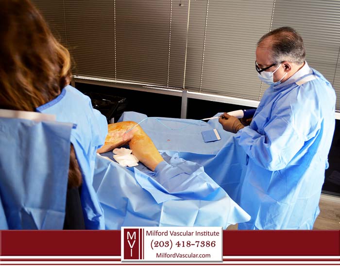 VenaSeal Vein Removal New Haven CT by Vascular Surgeon Dr Esposito