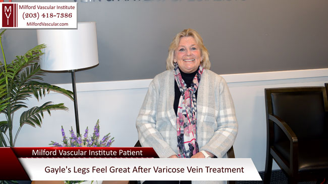 Vein Treatment New Haven CT by The Best Vein Specialists