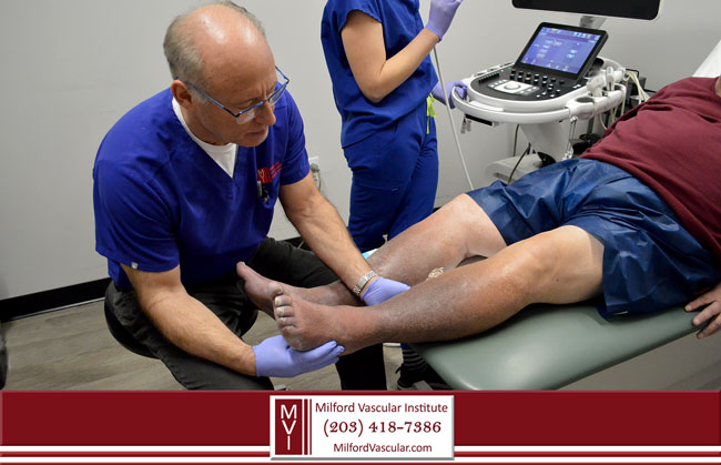 New Haven CT Vein Screening by the Best Vein Doctors