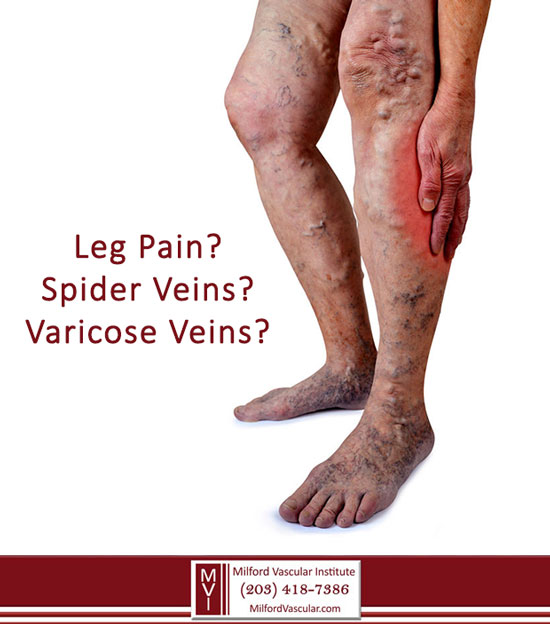 Venous Insufficiency New Haven CT