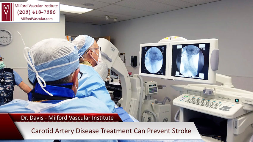 Carotid Artery Surgery New Haven CT For Stroke Prevention