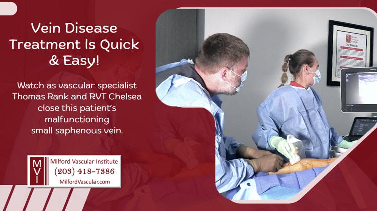 Vein Disease Treatment New Haven CT Using Radiofrequency Ablation