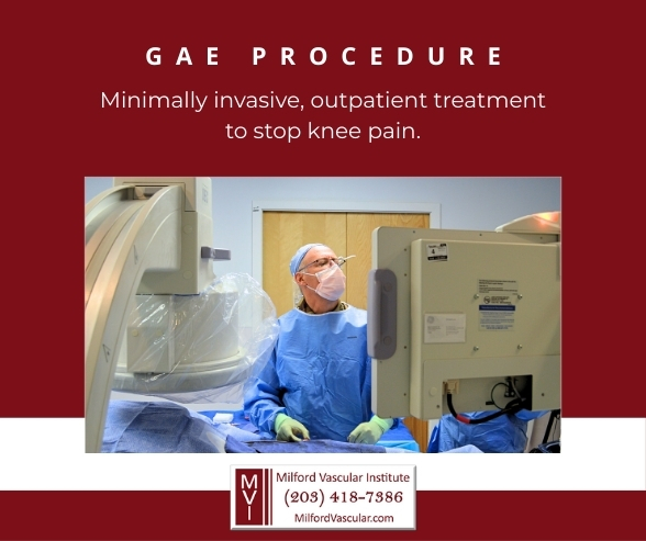 Geniculate Artery Embolization New Haven CT